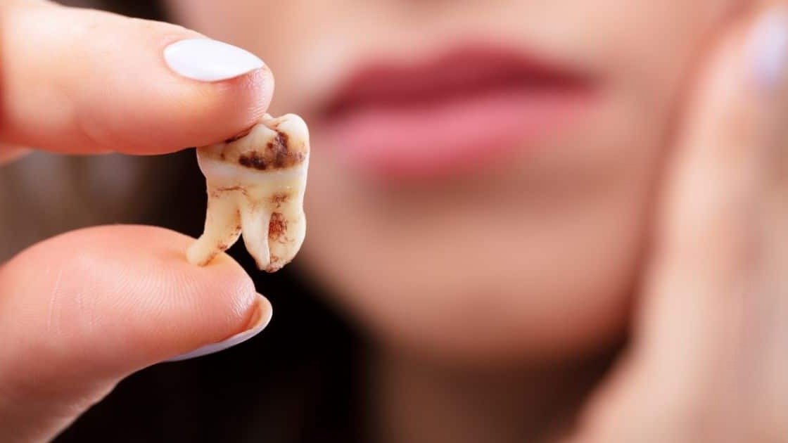 dientes, dientes flojos, consejos, salud bucal